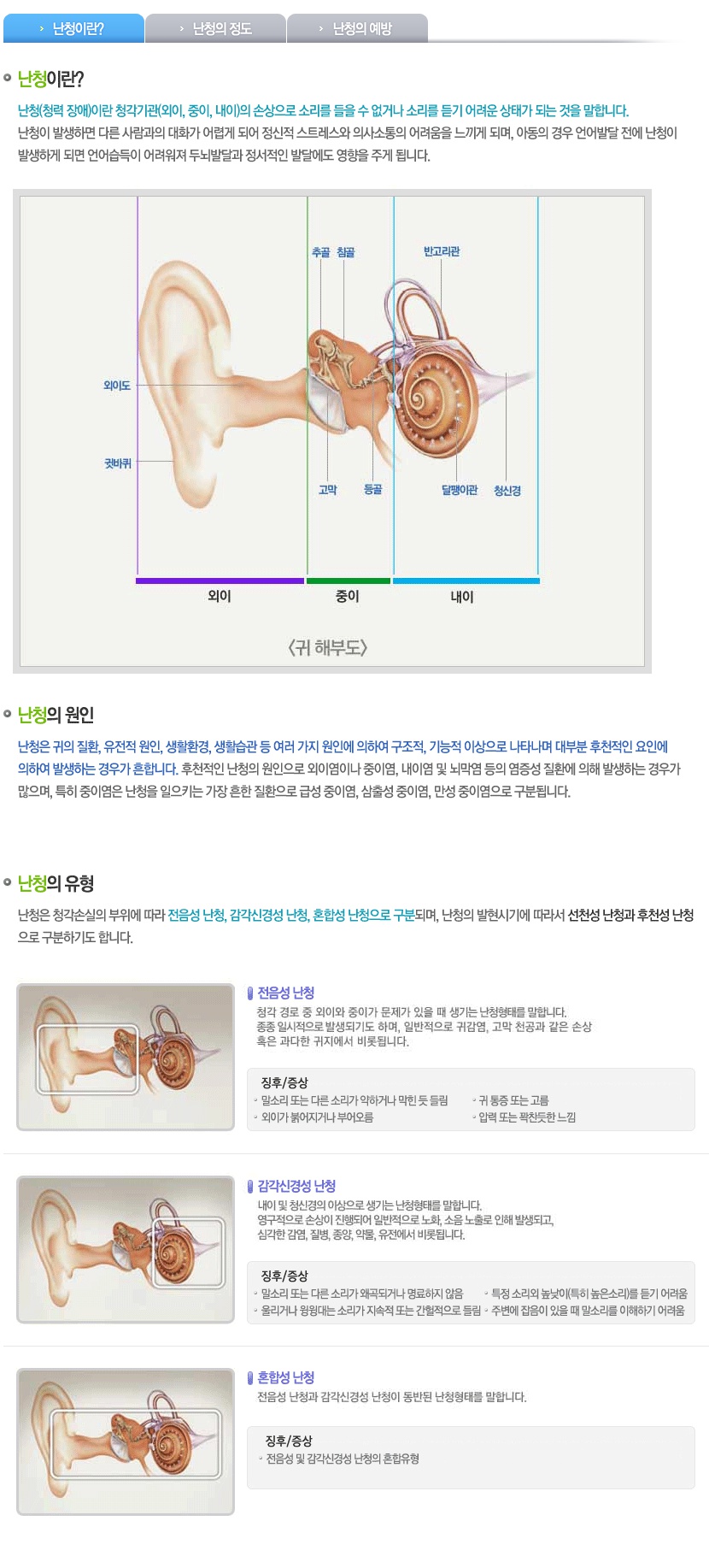 난청이란.jpg